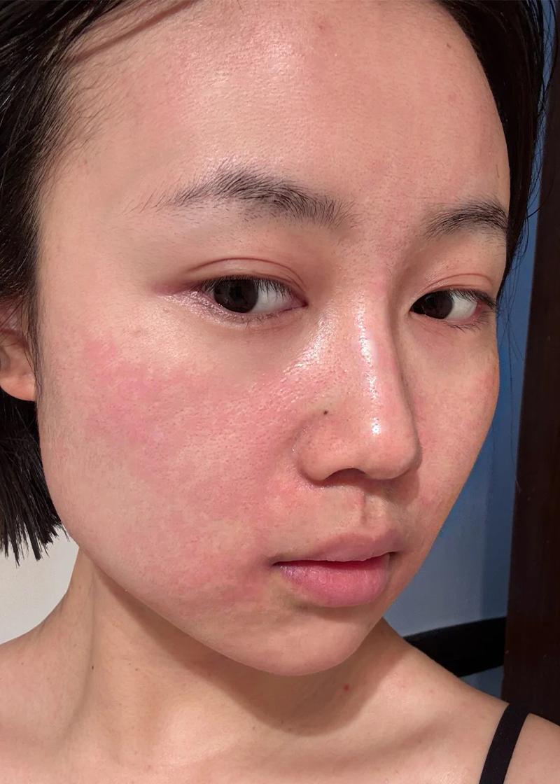 Da nhạy cảm Chị Mai Khanh - Trước