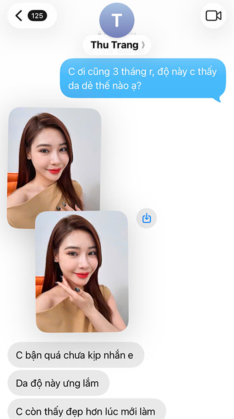 Nâng cơ Chị Thu Trang | Chủ spa