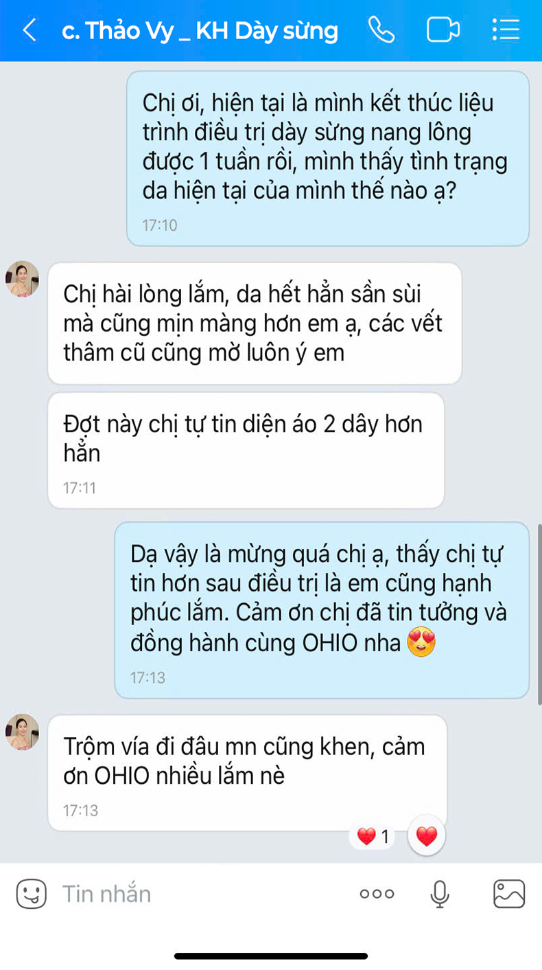 Dày sừng nang lông Chị Thảo Vy | Giám đốc nhân sự