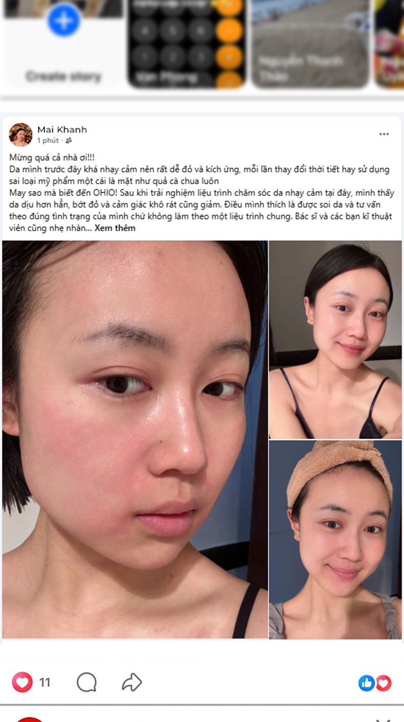 Da nhạy cảm Chị Mai Khanh
