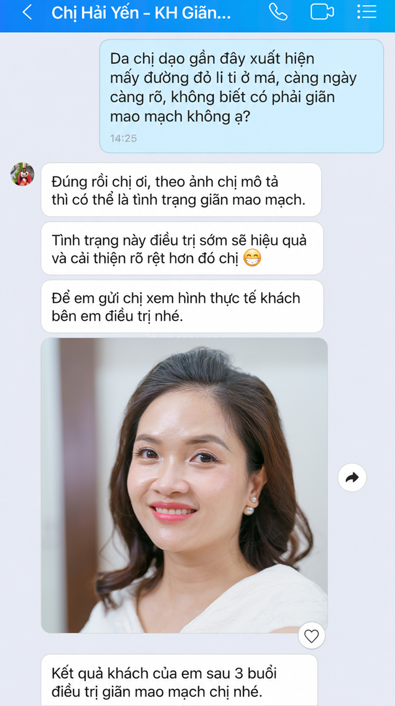 Giãn mao mạch mặt Chị Mỹ Trang | Kinh doanh