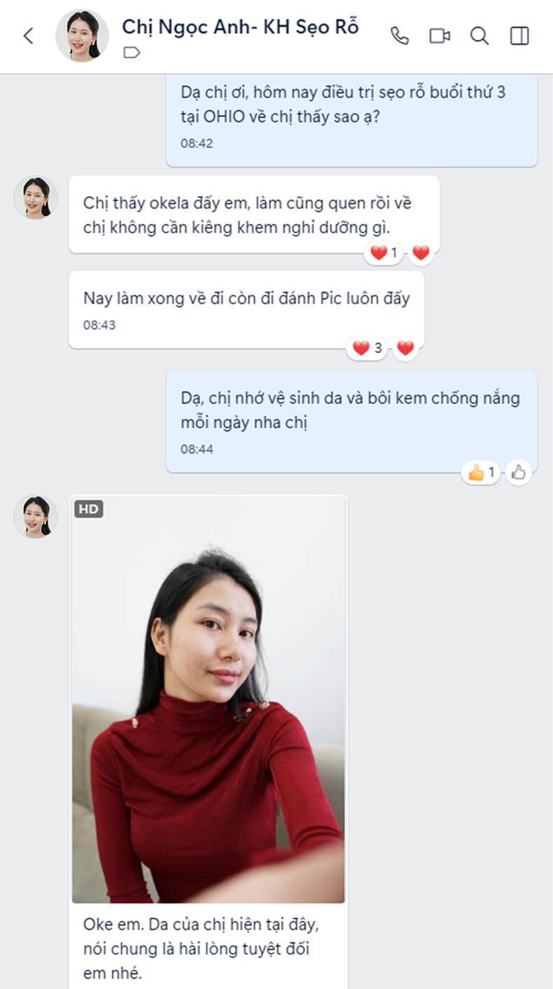 Sẹo rỗ Chị Ngọc Anh | Kinh doanh