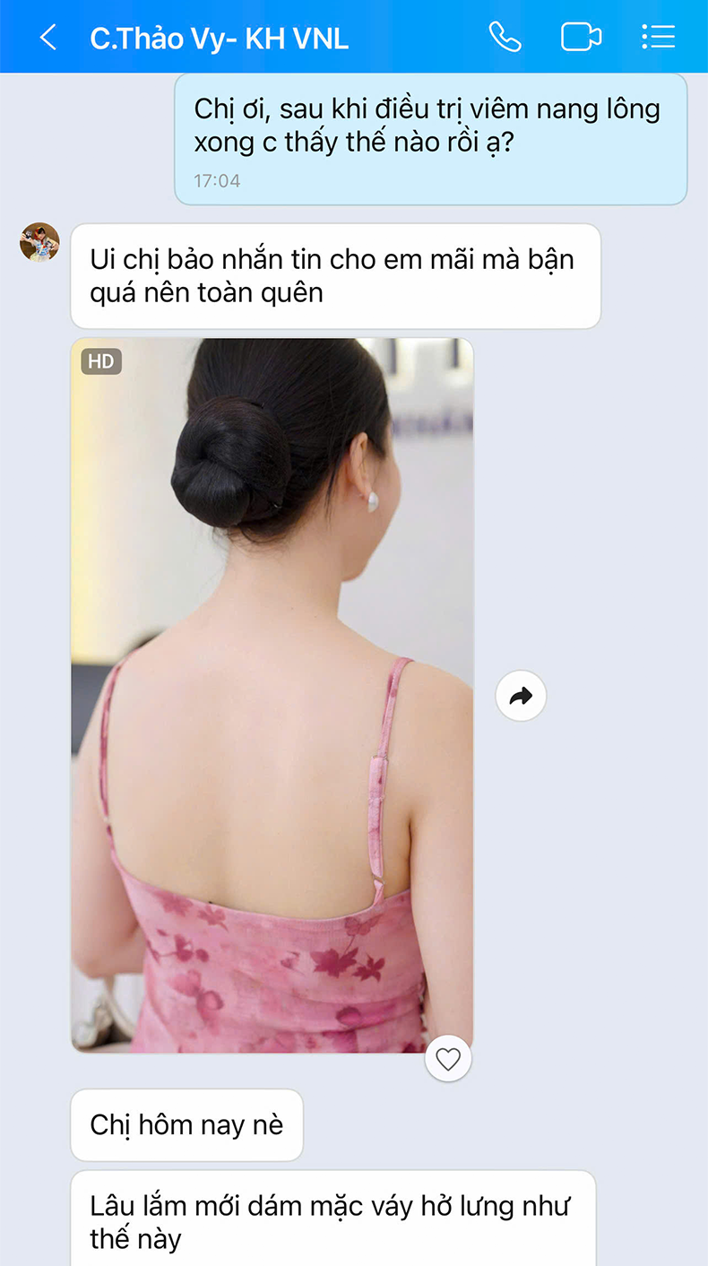 Viêm nang lông Chị Thảo Vy | Giám đốc nhân sự