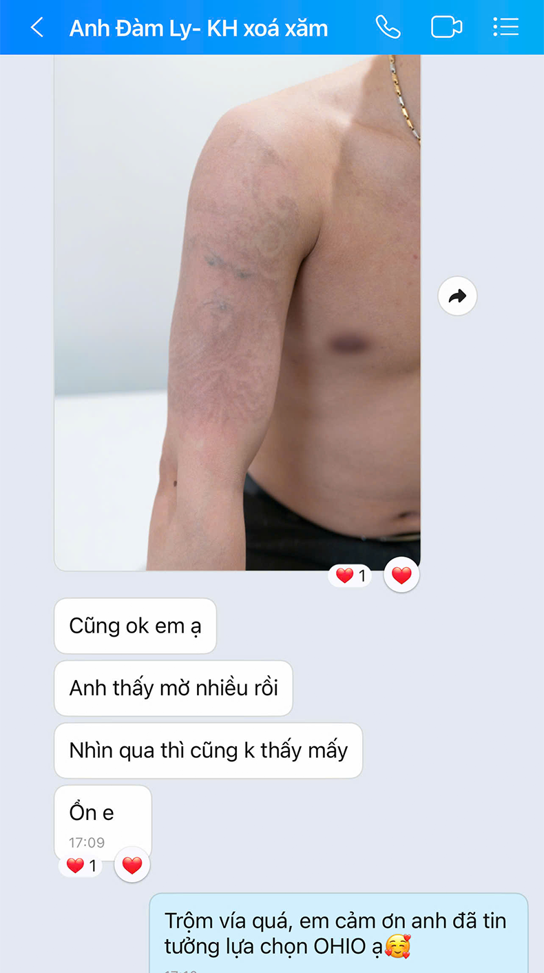 Xoá xăm Anh Đàm Ly | Chủ shop