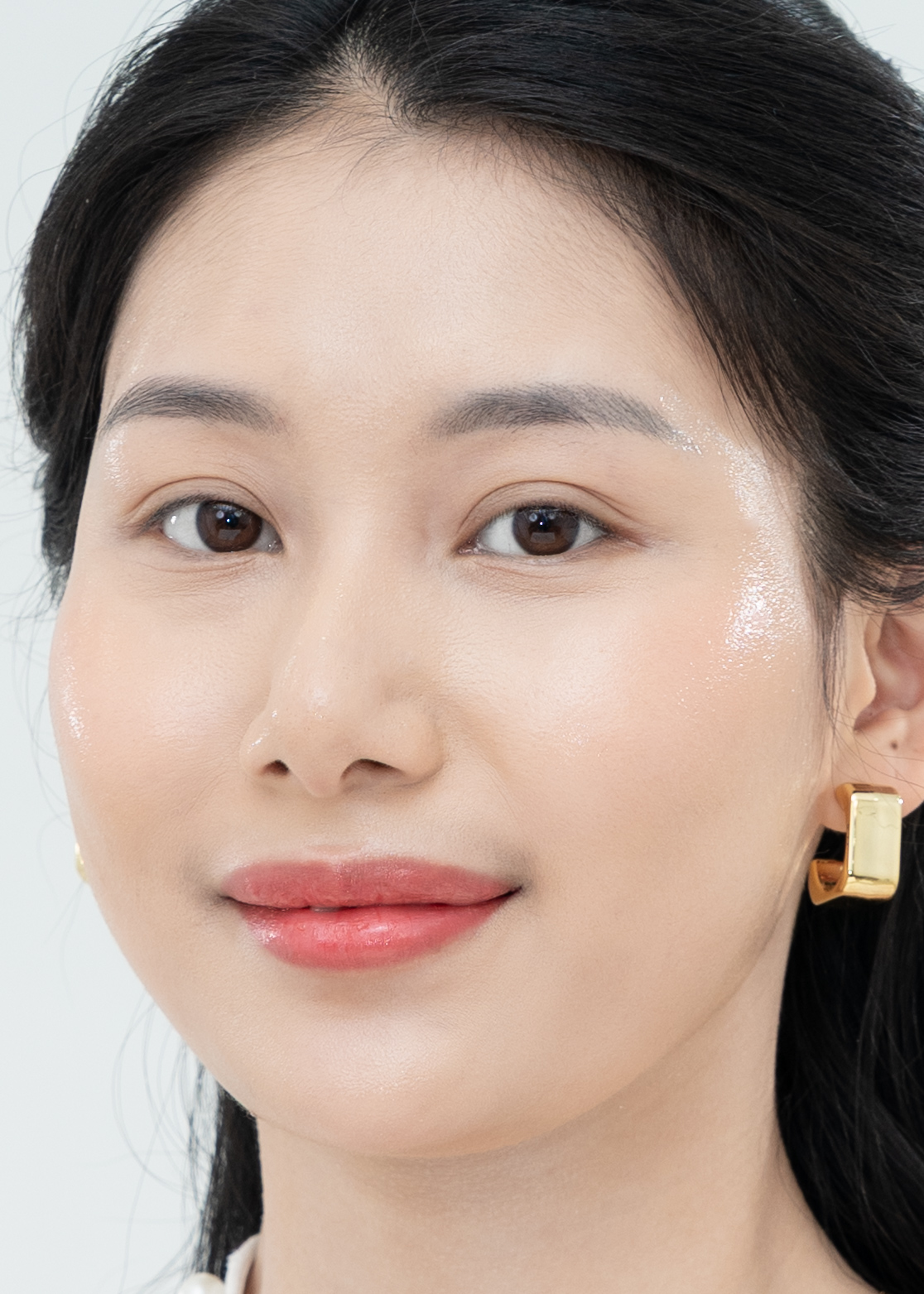 Sẹo rỗ Chị Ngọc Anh | Kinh doanh - Sau